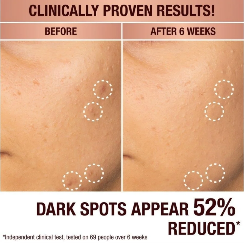 Charlotte Tilbury brightening serum